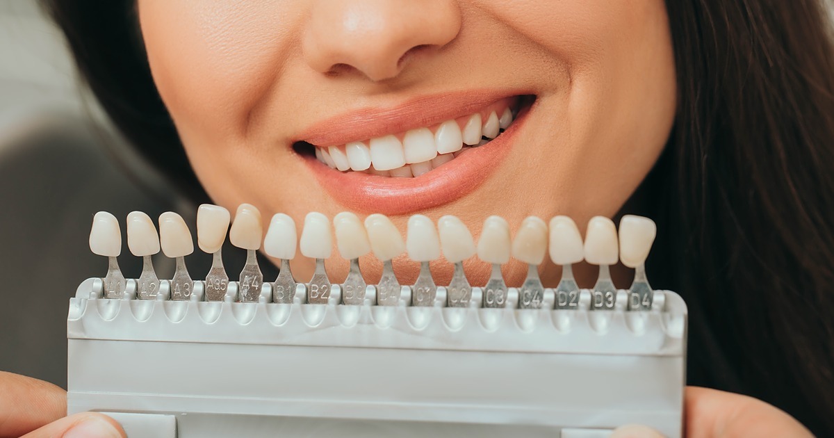 Teeth Whitening