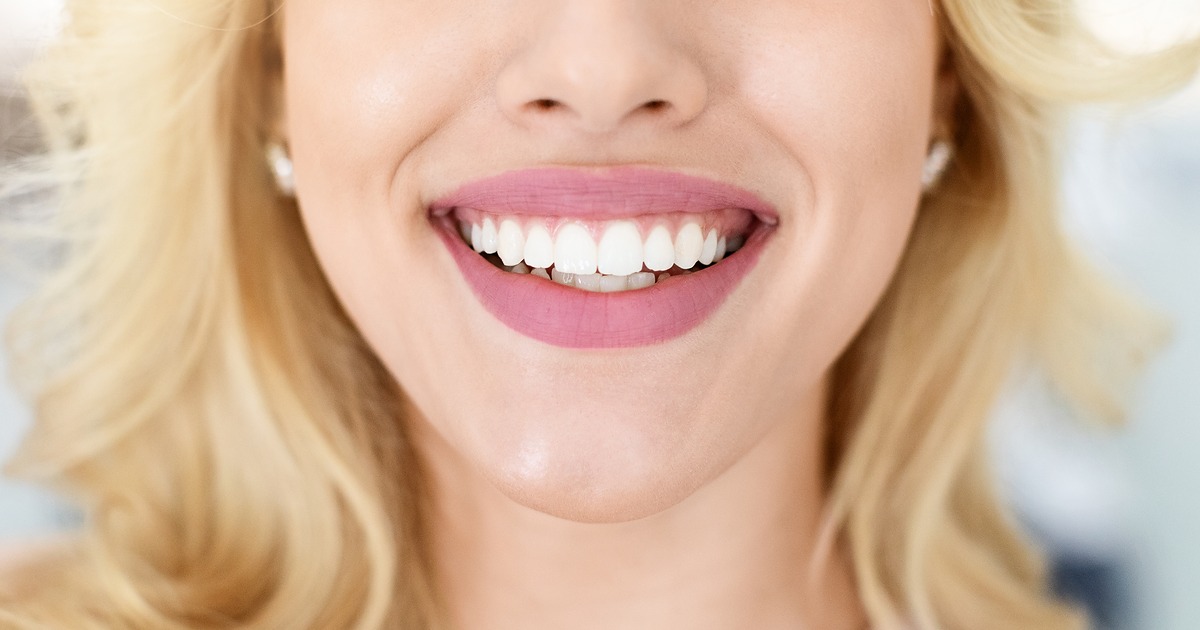 Dental Tooth Whitening