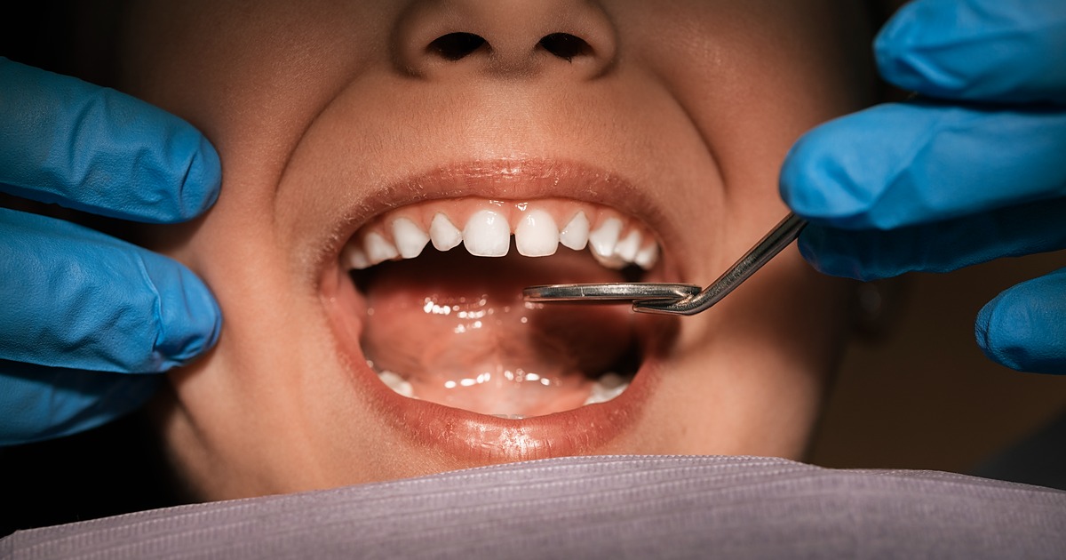 Early Signs of Gingivitis You Shouldn’t Ignore