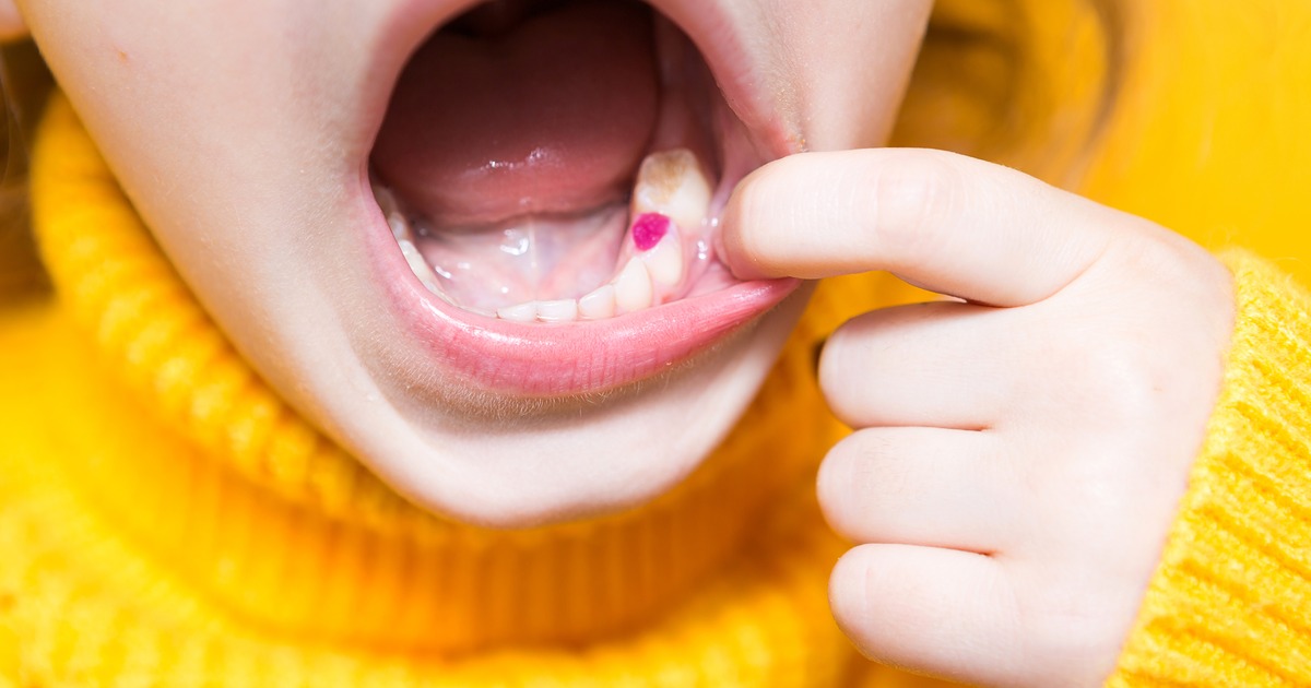 wen do kids molar come in