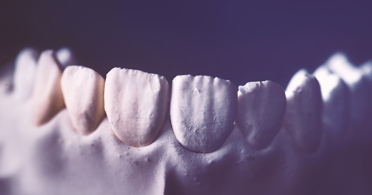 white spot on teeth