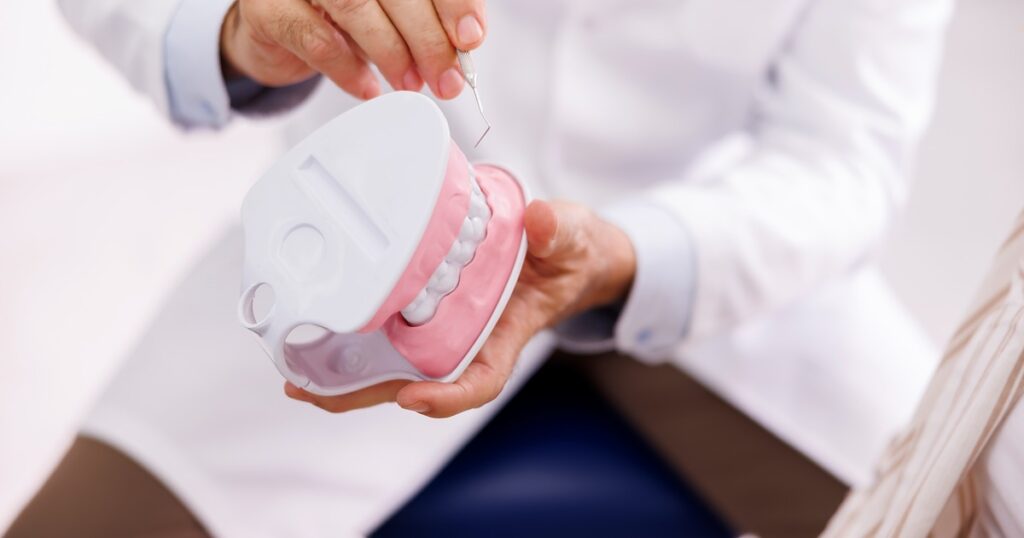floss Molar